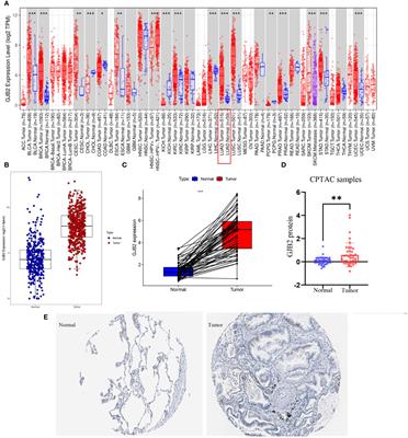 Ion channel gene GJB2 influences the intercellular communication by Up-regulating the SPP1 signaling pathway identified by the single-cell RNA sequencing in lung adenocarcinoma